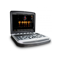 Портативный УЗИ аппарат кардиологический экспертного класса SonoBook 8 Chison Medical Imaging Co (КНР)